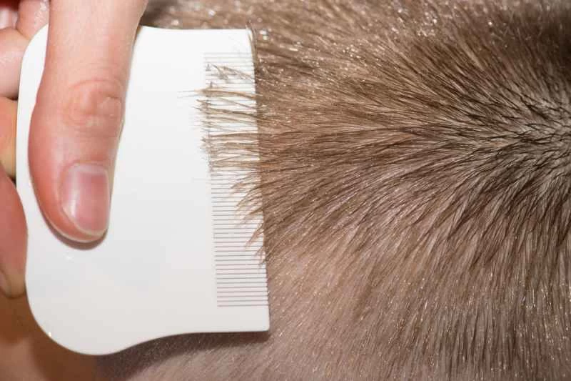 細齒密齒梳梳理著短而淺的金髮。